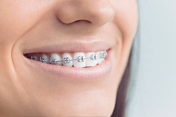 Full Mouth Reconstruction in Gilcrest, CO